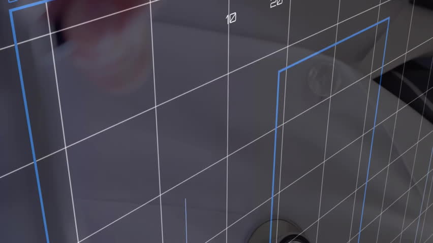 Animation of financial data processing over caucasian male doctor. Global medicine, connections, computing and data processing concept digitally generated video. - Powered by Shutterstock - Get 15% off with code: PIKWIZARD15