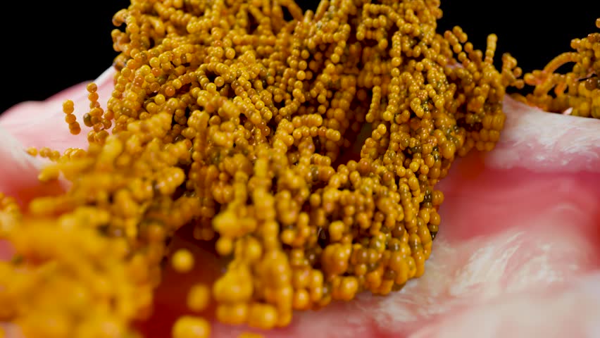 Fat Cell Growth Inside Human Body, Representing Obesity, Weight Gain  and Metabolic Disorders, Adipose Tissue Expansion and Overeating, Poor Nutrition, 3d render