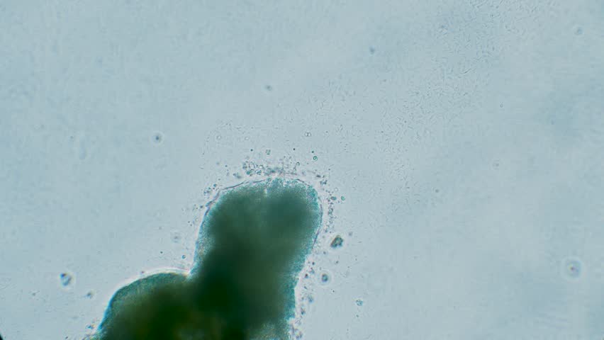 Slime mold plasmodium under microscope surrounded by bacteria
