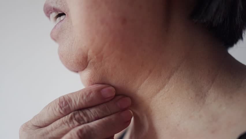Double chin face mature woman 50 years old, human fat neck, side view, wrinkles on skin, facelift, age-related skin changes, aesthetic injection cosmetology, care anti-aging procedures