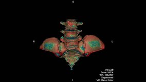 3D Visualization of Human Sacrum and Pelvic Spine Anatomy on Black Background
 - Powered by Shutterstock - Get 15% off with code: PIKWIZARD15