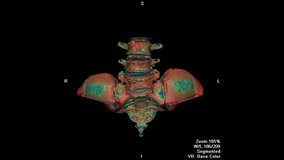 3D Visualization of Human Sacrum and Pelvic Spine Anatomy on Black Background
 - Powered by Shutterstock - Get 15% off with code: PIKWIZARD15