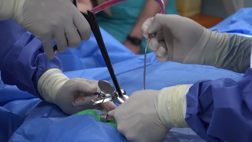 Spine Surgery Explained: Common Procedures, Recovery Expectations, Risks, and Advances in Minimally Invasive Techniques for Treating Chronic Back Pain and Spinal Disorders"