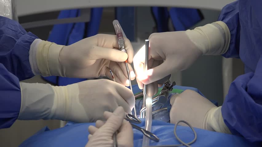 Spine Surgery Explained: Common Procedures, Recovery Expectations, Risks, and Advances in Minimally Invasive Techniques for Treating Chronic Back Pain and Spinal Disorders"