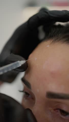 Close-up of cosmetic injections in the forehead. Concept of rejuvenation procedure.