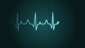 Electrocardiogram Heartbeat Line Animation, Heartbeat Monitor Animation with Spiking Signal Line in Medical Theme - Powered by Shutterstock - Get 15% off with code: PIKWIZARD15