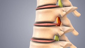 Spinal Decompression Therapy Explained in Medical Animation - Powered by Shutterstock - Get 15% off with code: PIKWIZARD15