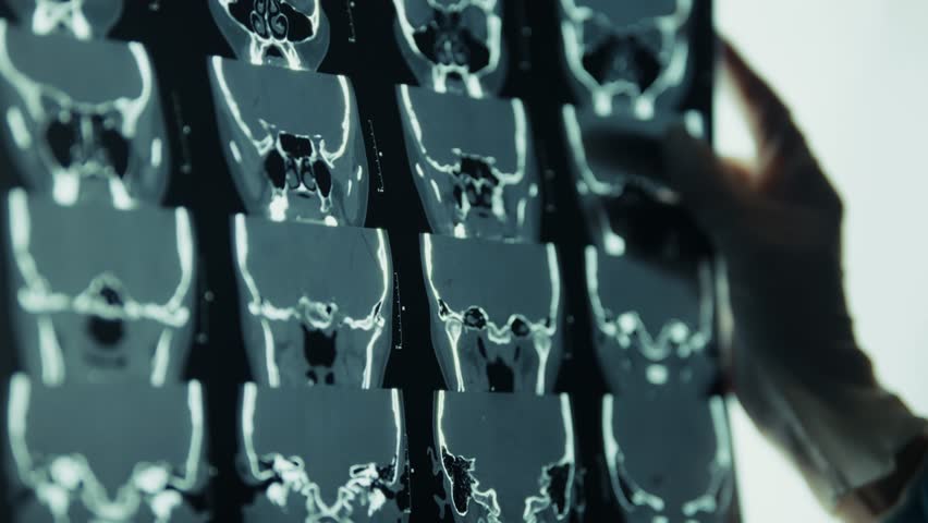 Doctor Holding X Ray. Medical Research Specialist. Scientific Medical Study. Physician Examining Results. Medical Imaging Analysis. Doctor In Clinic. Medical Diagnosis Process. Patient Diagnosis Scan