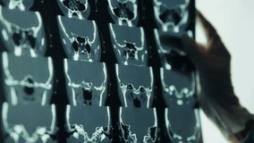 Doctor Holding X Ray. Medical Research Specialist. Scientific Medical Study. Physician Examining Results. Medical Imaging Analysis. Doctor In Clinic. Medical Diagnosis Process. Patient Diagnosis Scan - Powered by Shutterstock - Get 15% off with code: PIKWIZARD15