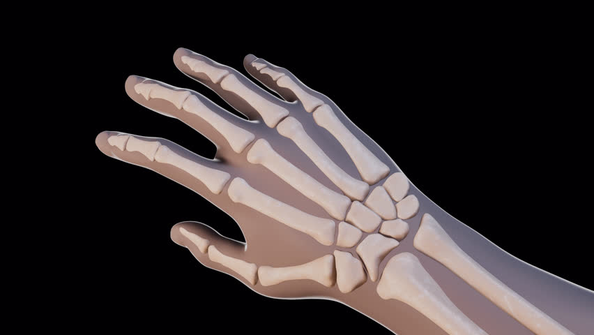 This 3d animation shows the osteoarthritis of the hand