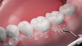 Water from an oral irrigator cleans between teeth to prevent periodontitis. Mouthwash or toothpaste containing plant extracts freshens breath and promotes gum health. Oral hygiene product ads. 3D. - Powered by Shutterstock - Get 15% off with code: PIKWIZARD15