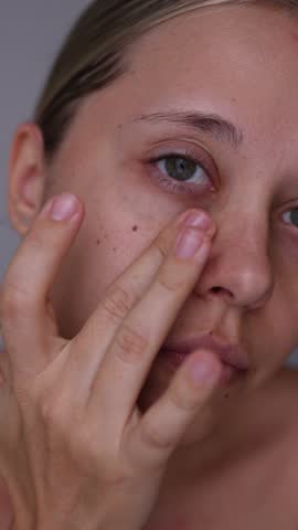 Vertical video of a young woman gently touching the skin under her eyes, showing visible dark circles in close-up shot. Her expression reflects tiredness and self-awareness