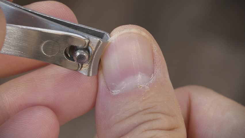Man cuts his fingernails using a nail clipper