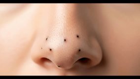 Close-Up of Woman’s Nose with Blackheads and Skin Pores – Dermatology and Cosmetology Concept in High-Quality 4K Video
 - Powered by Shutterstock - Get 15% off with code: PIKWIZARD15