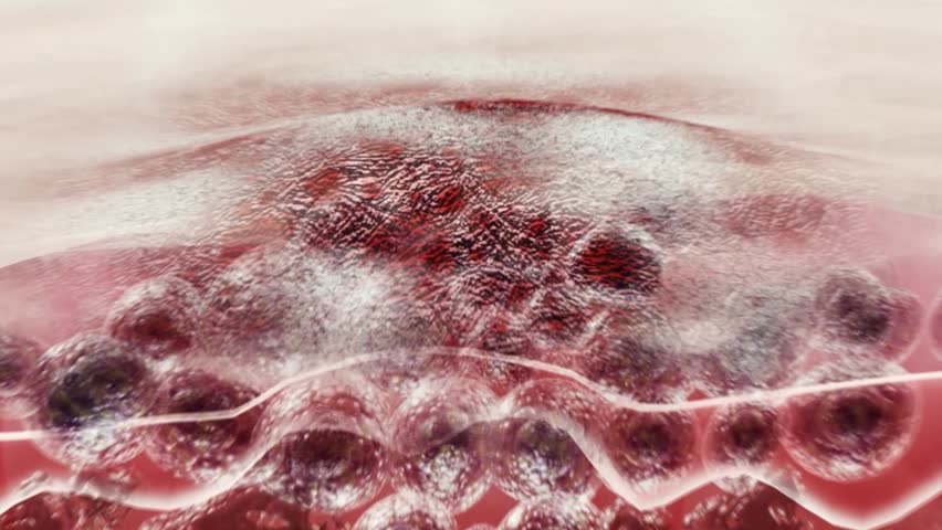 Skin cells continuously secrete melanin, causing spots and wrinkles on the face, skin aging caused by aging and UV exposure,dull and dehydrated skin, concept of skin care beauty solution.3D animation.