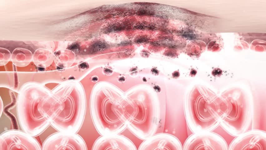 Skin cell melanin disappears, facial spots and wrinkles disappear, skin whitening, anti-wrinkle and anti-aging, laser beauty, concept skin care beauty solution. Cosmetics advertising, 3D animation.