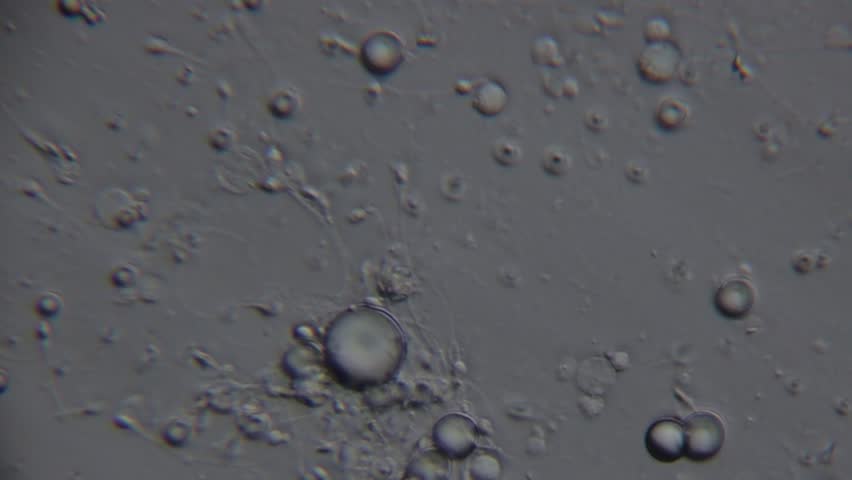 Microscopic view of spermatozoa, showing numerous round cells and a few with visible tails, moving in a fluid medium under magnification.