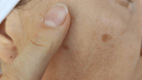 Women's skin 40-50 years old, pigmented dark spots on the face, enlarged pores. Care and cosmetology. Simple close-up video. - Powered by Shutterstock - Get 15% off with code: PIKWIZARD15