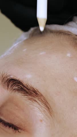 Beauty injection. anti-aging injections. botulinum therapy. Facial rejuvenation. Doctor makes markings on patient's forehead for beauty injections. collagen injections. Beauty concept.