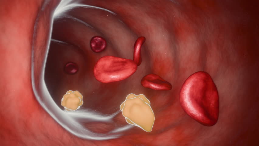 This 3d animation shows a vein blood flow with  cholesterol particles 