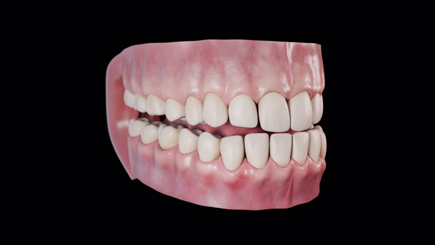 This 3d animation shows the periodontitis disease 