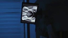 Doctor and X-ray. X-ray. Vertical video. Hip joint. Slow motion. High-quality video recording in 4K format. - Powered by Shutterstock - Get 15% off with code: PIKWIZARD15
