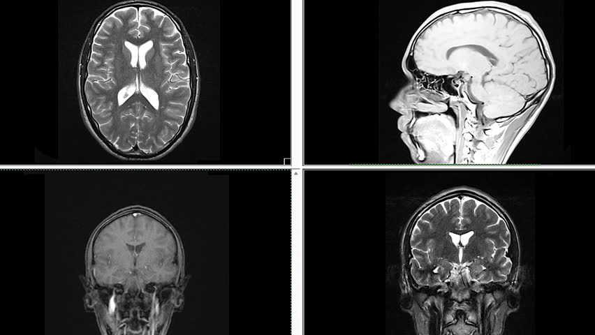 Voluminous MRI scans of the brain and head to detect tumors. Diagnostic medical tool