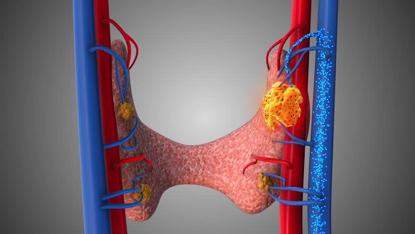 Human Parathyroid Gland Infection and Hyper parathyroid Disorder