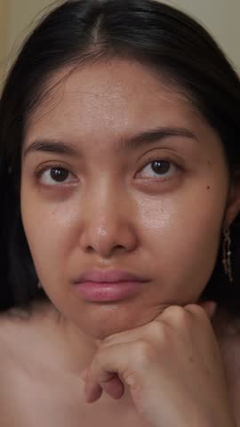Pretty young Asian woman showing dry and dull skin on her face to the camera.
