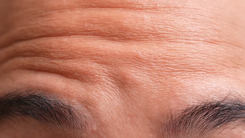 A close-up of an Asian person’s wrinkled forehead shows early signs of aging. Also reflects stress, skin health, life experience, self-care awareness, and the effects of time on physical appearance.

