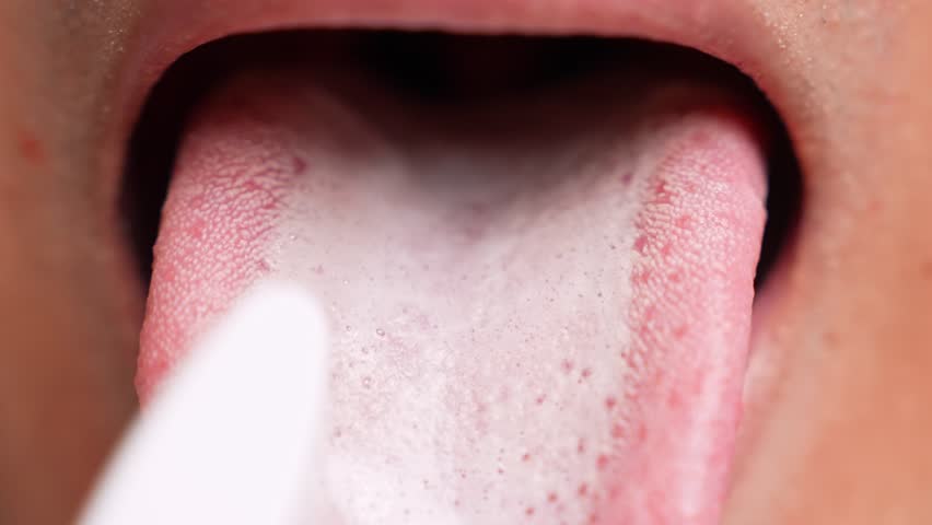 A close-up of tongue brushing highlights the importance of complete oral hygiene. Also conveys thorough self-care, freshness, prevention of bad breath, healthy routines, and attention personal health.