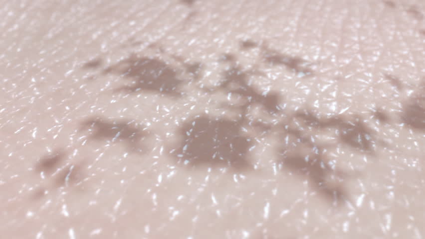 Melasma treatment before and after. Reduce skin pigmentation and dark spots. Results of laser therapy, microneedling, chemical peels, skin whitening cream with tranexamic acid. 3D rendered animation