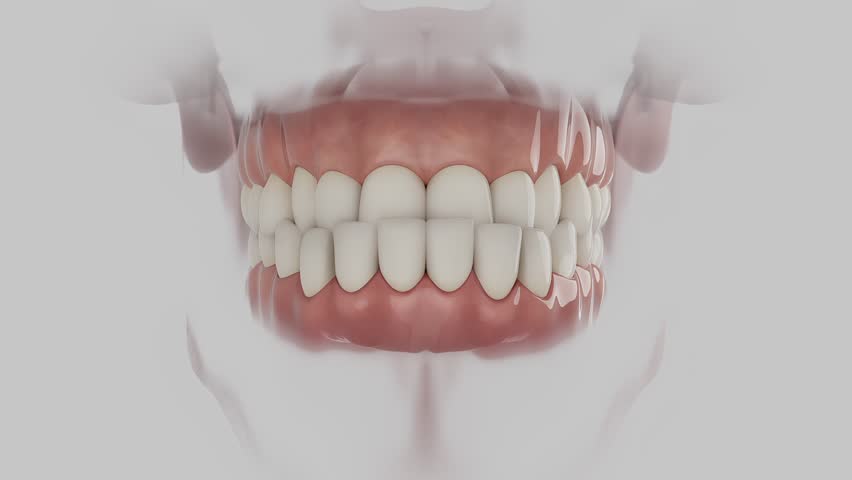 3D Dental Animation — Overjet Bite Correction with Clear Aligner
