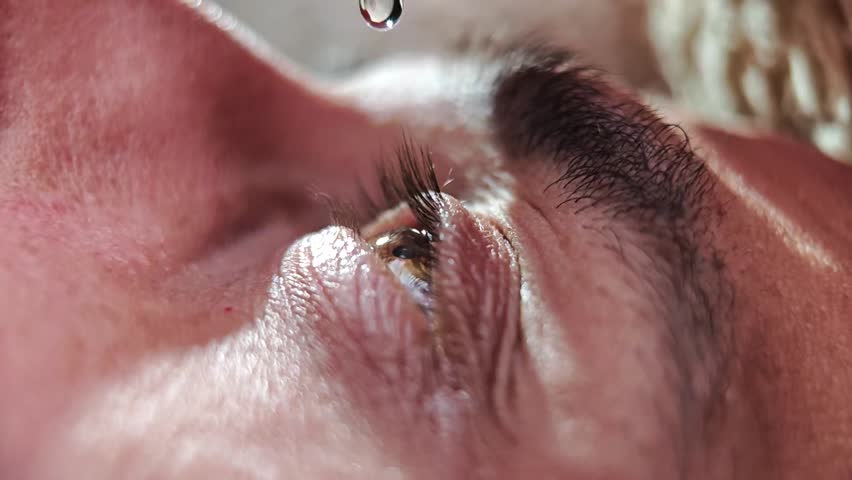 Medical eye drop falling onto a human eyeball for treatment.