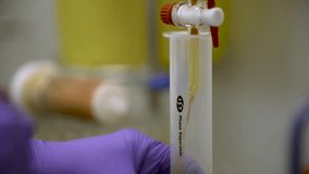 Close-up detailed view of a scientist in blue disposable gloves filtering orange liquid into a round-bottom flask in a laboratory — themes of science, chemistry, accuracy, and healthcare. - Powered by Shutterstock - Get 15% off with code: PIKWIZARD15