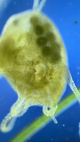 Hydra Eating Daphnia under the Microscope at 40x Magnification