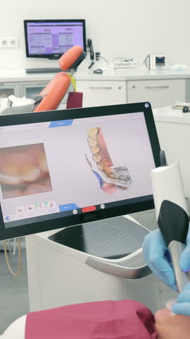 Dentist scans the patient's teeth using the CEREC scanner. Modern dentistry. The dentist uses a 3D dental intraoral scanner to scan the patient's teeth