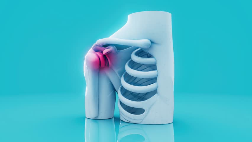 Conceptual 3D Animation of Shoulder Inflammation and Joint Pain