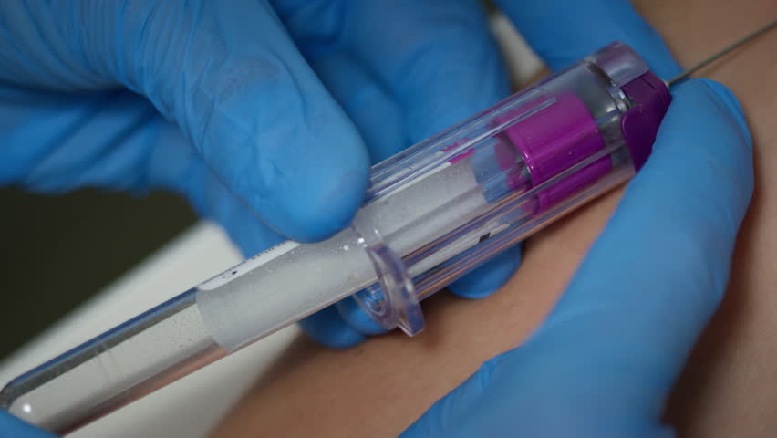 Blood drawing process, a needle inserted into the vein, collecting blood into a test tube, close up shot. Venipuncture and laboratory testing concepts.