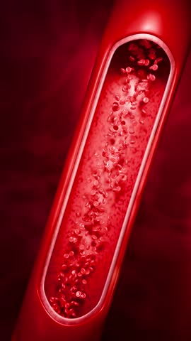 Artery clogged by unhealthy junk food, sugary drinks, and alcohol, illustrating serious cardiovascular risks, atherosclerosis, and heart disease problems in human blood vessels. 3D rendering.