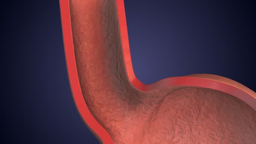 Gastroesophageal Reflux Disease Affecting Human Digestive System