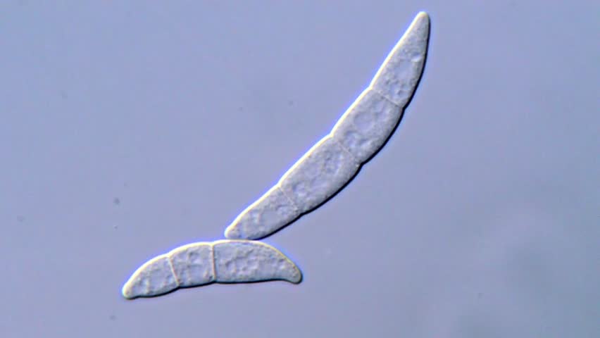 Fusarium Fungus Spore Chains Under High Resolution
