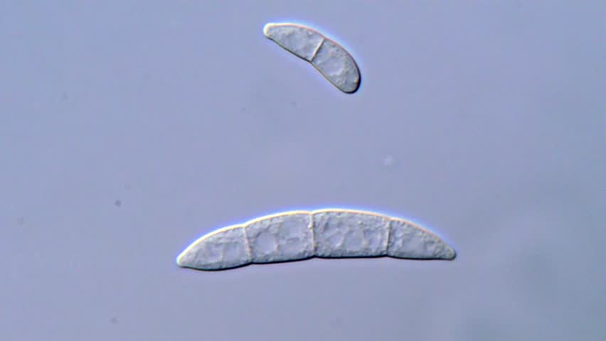 High Resolution Microscopy of Fusarium Spores