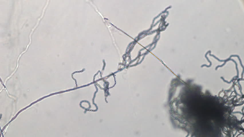 Hyphae of mold mycelium with cells, aerial mycelium and mold spores under a microscope.