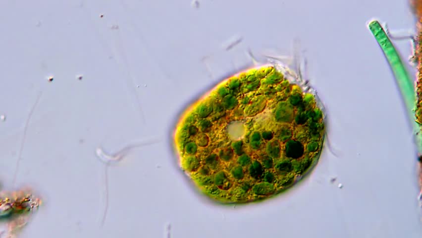 High Definition Footage of euplotes ciliate Under Microscope