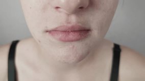 Macro front view of female face with a gentle, closed-mouth smile highlighting her dimples. This shot details real skin texture, including visible pores, acne, and blemishes on her chin and cheeks. - Powered by Shutterstock - Get 15% off with code: PIKWIZARD15