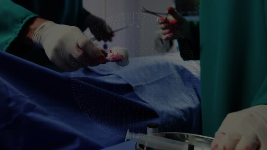 Surgeons incising under drape activating hologram globe turning showing medical network. Medical, innovation, technology, collaboration, precision, healthcare, futuristic - Powered by Shutterstock - Get 15% off with code: PIKWIZARD15