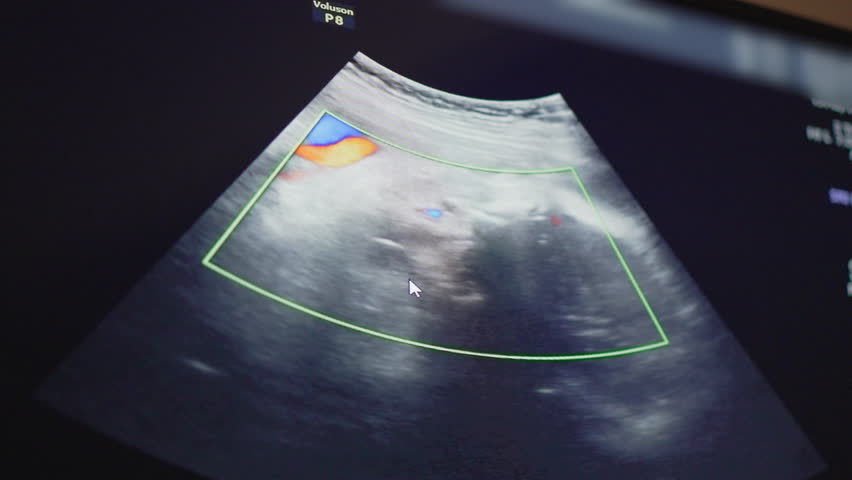 Ultrasound screen showing baby during prenatal checkup. Pregnancy healthcare, early motherhood, baby development and medical diagnostics concept.