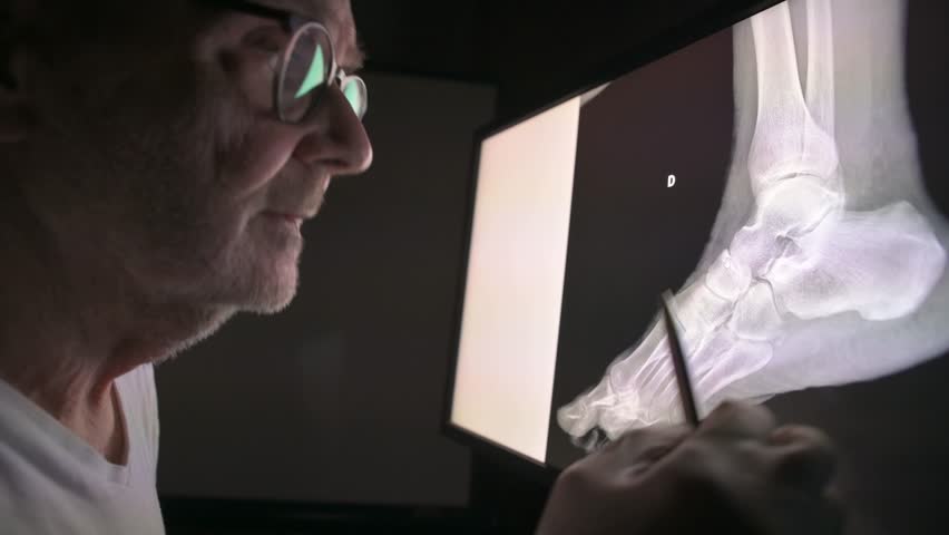 A clinician analyzes a detailed foot X-ray displayed on a monitor, using a pencil to point out areas of interest. The image conveys medical imaging, diagnosis, and careful orthopedic assessment.