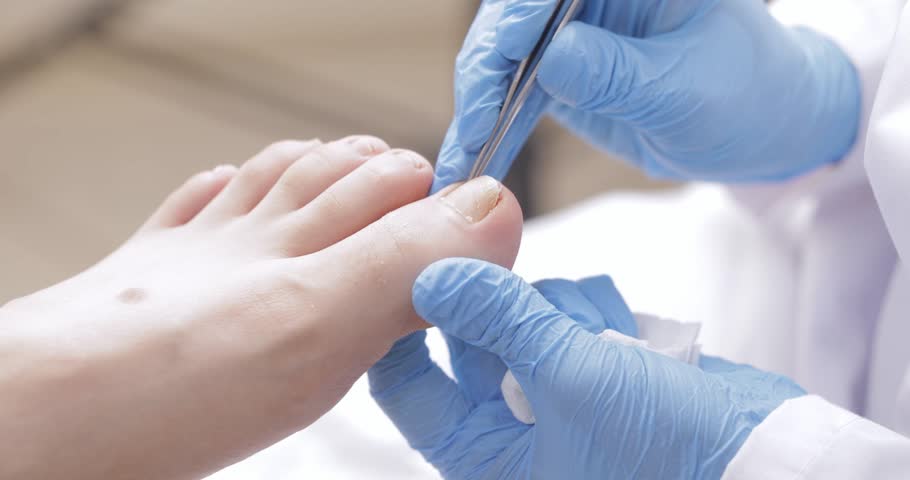 Closeup of podiatrist performing toenail care pedicure on caucasian female adult patient foot.